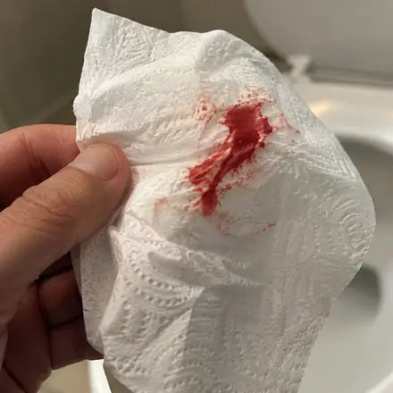 Blood on toilet paper