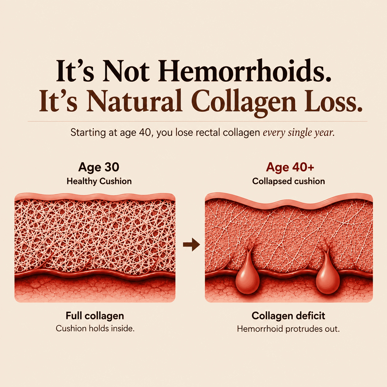 Venalys Collagen Cushion Support Capsules